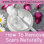 How To Reduce Scars