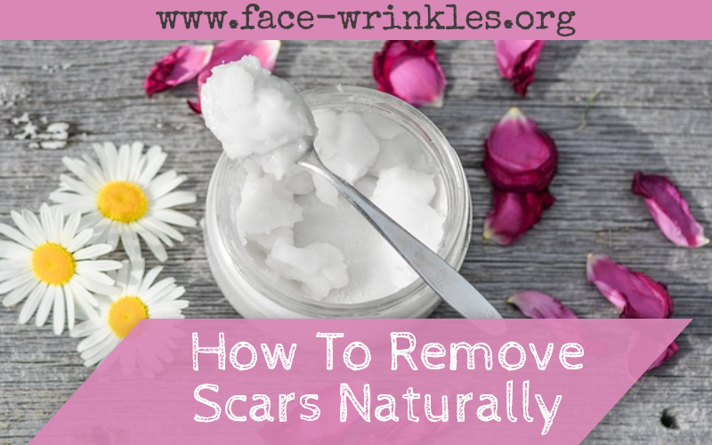 How To Remove  Scars Naturally