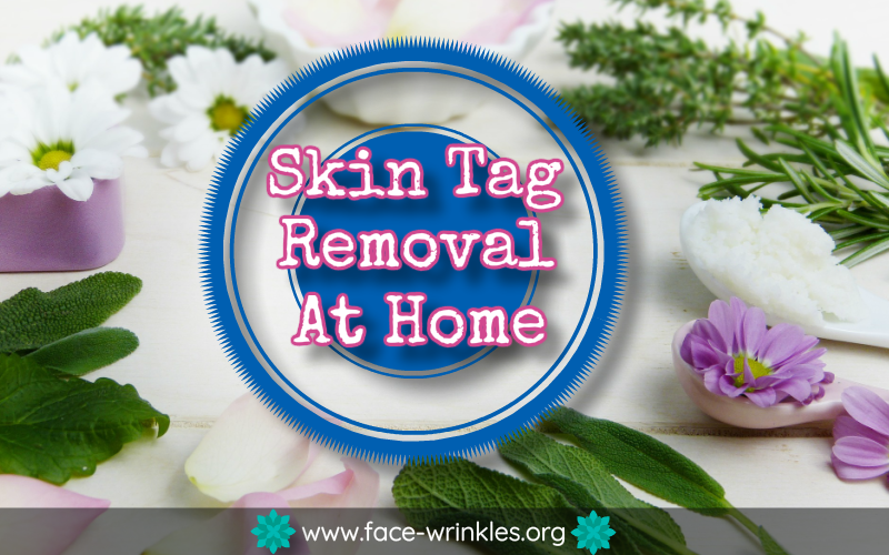 Tips On Skin Tag Removal At Home