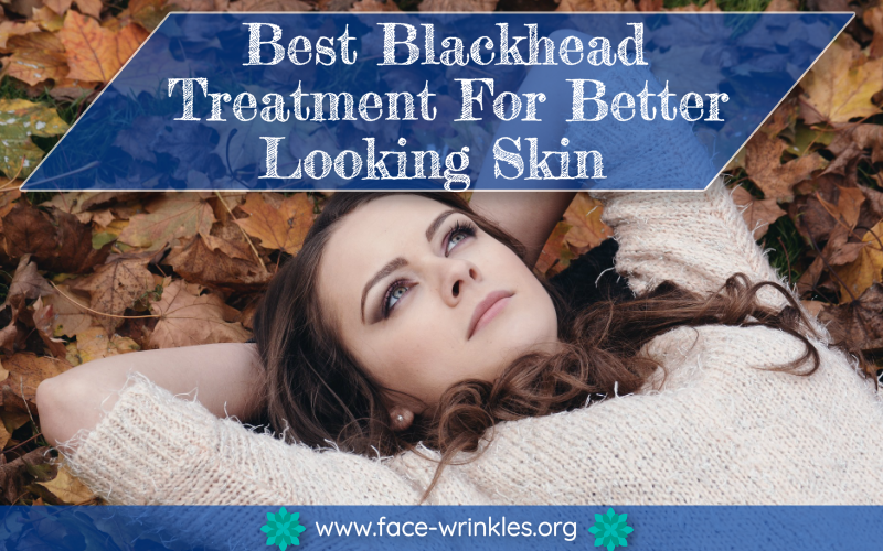 best blackhead treatment