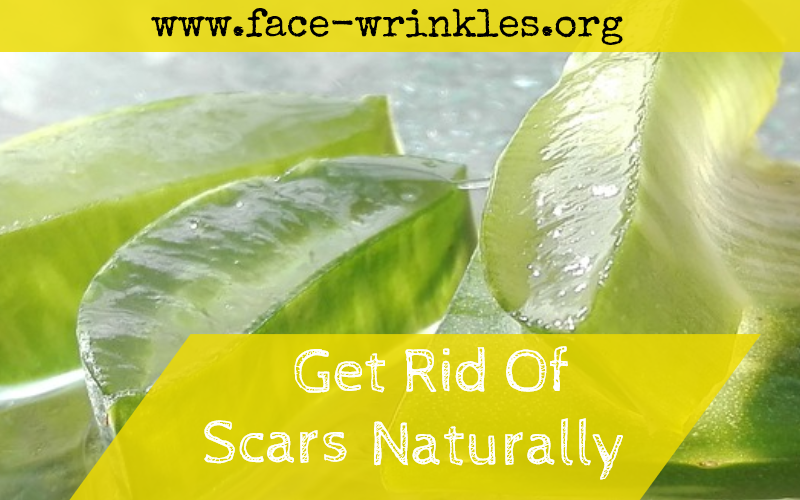 How To Remove Scars Naturally